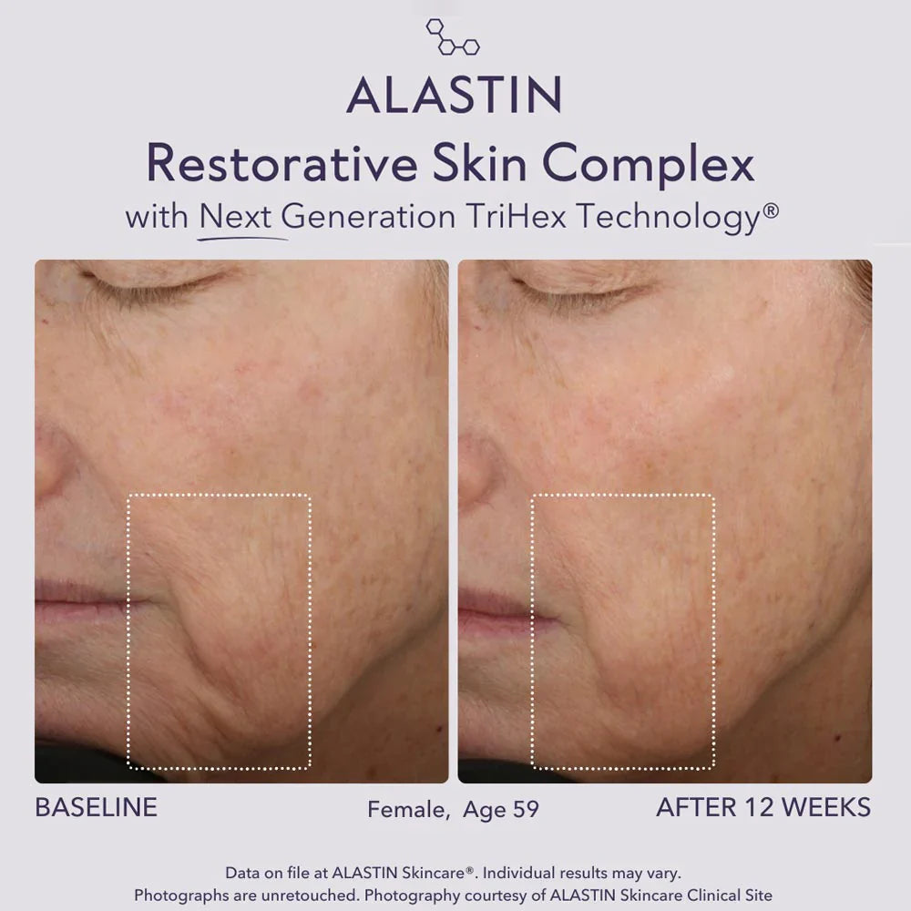 Alastin Restorative Skin Complex with TriHex Technology 29ml