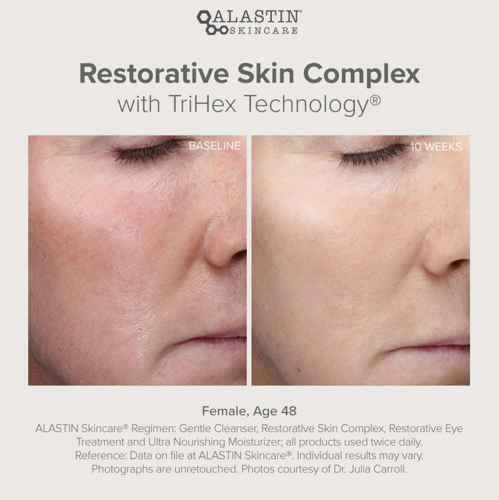Alastin Restorative Skin Complex with TriHex Technology 29ml